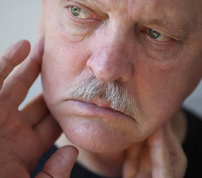 TMJ Disorder - old man